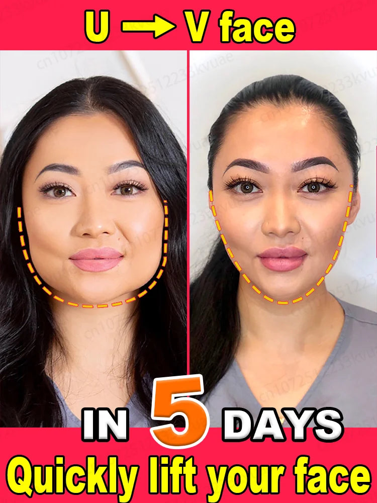 Crème pour le visage la plus vendue, débarrassez-vous de la forme élargie du visage, soulagez le gonflement du visage, liftez et