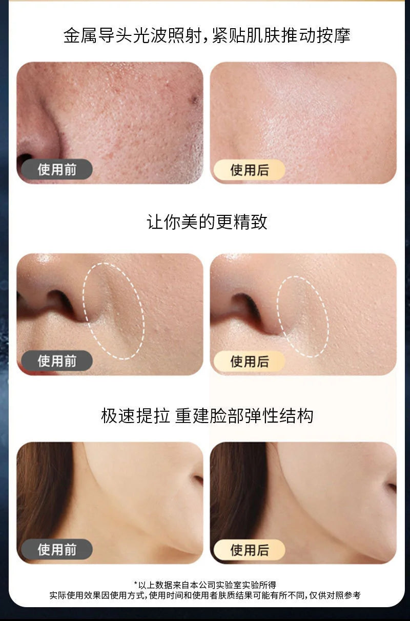 Appareil de massage facial anti-âge à microcourant pour thérapie par lumière rouge RF, instrument de beauté pour le raffermissement et le lifting du visage