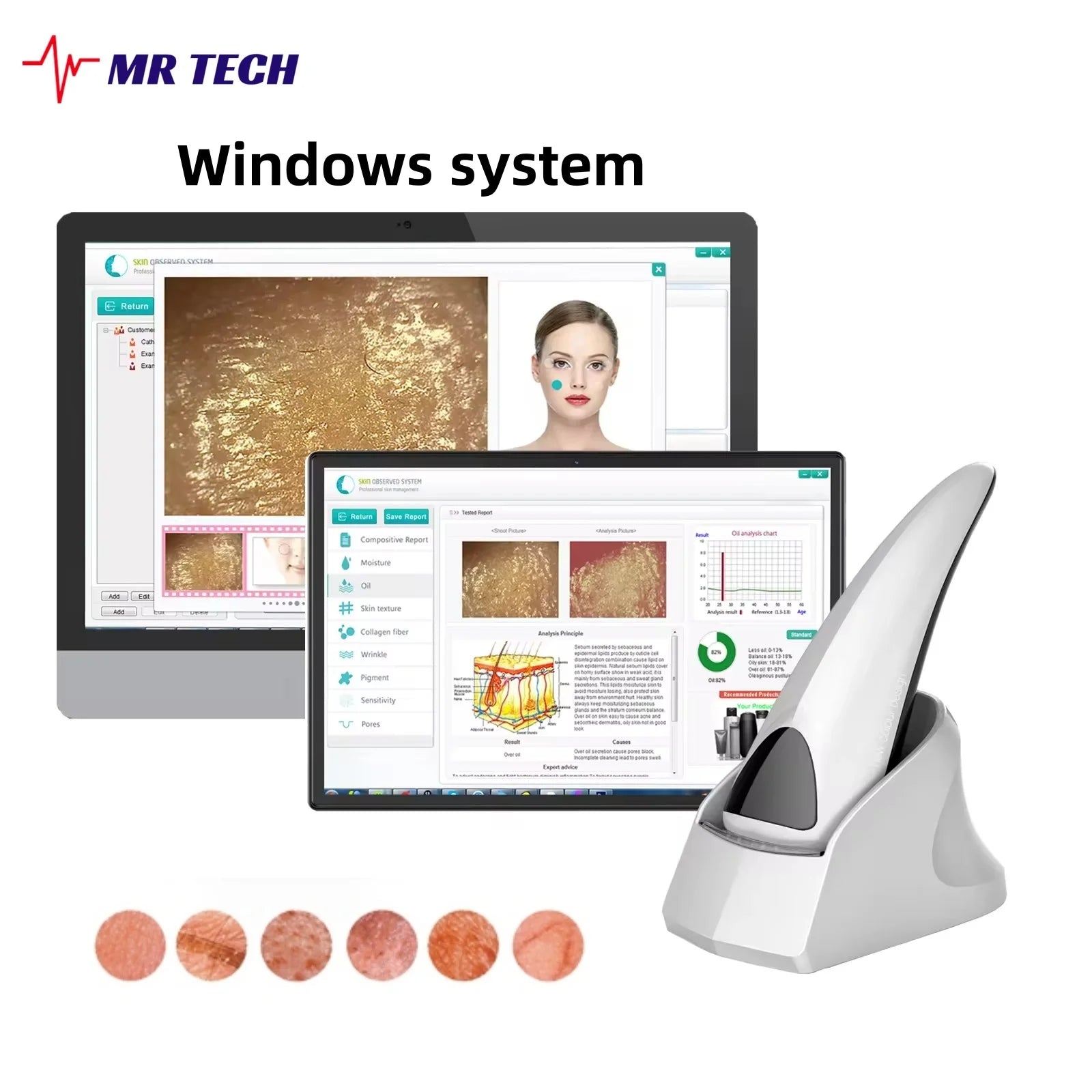 Analyseur de peau esthétique portable haute définition à pixels, diagnostic automatique de l'épiderme et du derme du visage, microscope pour salon de beauté