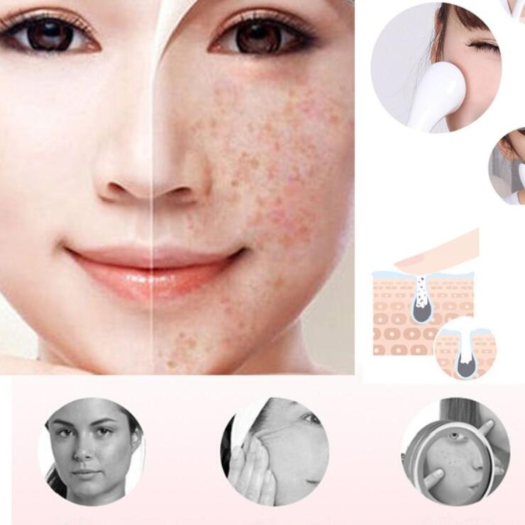 Appareil de beauté faciale à ultrasons haute fréquence anti-âge pour le traitement des taches et des rides - Soins de la peau - Livraison directe aux États-Unis