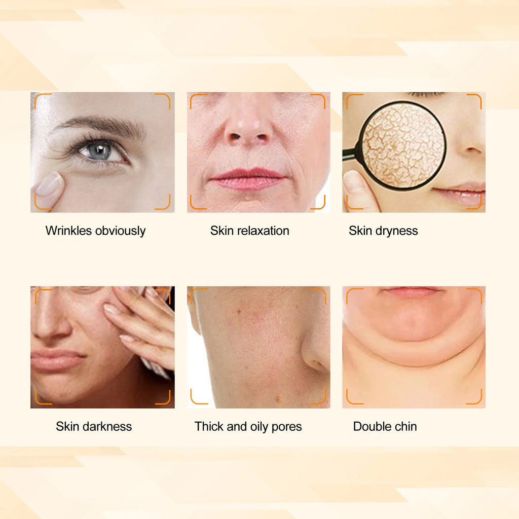 Appareil de beauté raffermissant et liftant pour le visage - Accessoire pour salon de beauté - Soins du visage, rajeunissement et anti-âge