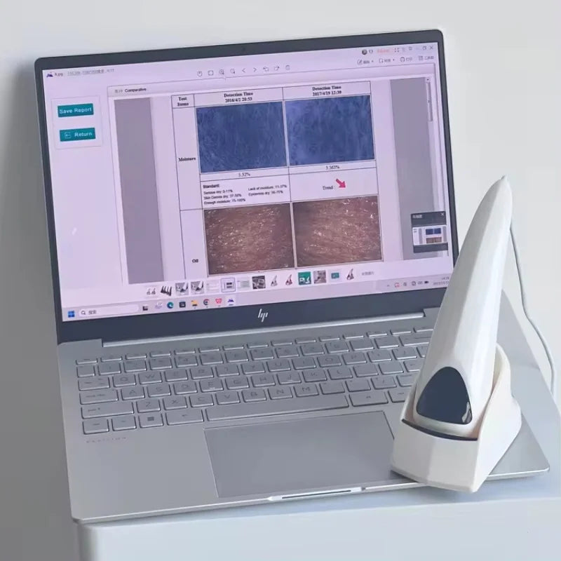 Analyseur de peau esthétique portable haute définition à pixels, diagnostic automatique de l'épiderme et du derme du visage, microscope pour salon de beauté