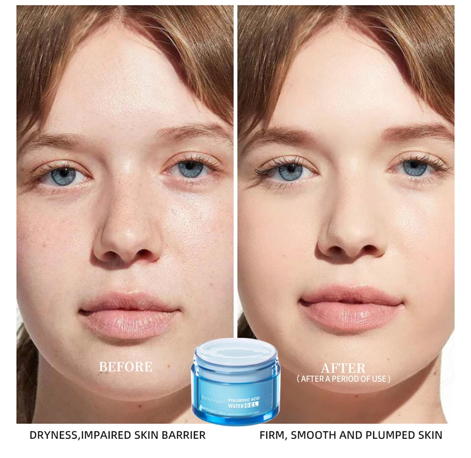 Crème gel à l'acide hyaluronique, soin hydratant pour le visage, pour hydrater et lisser les peaux très sèches, lotion nourrissante qui améliore la sécheresse cutanée