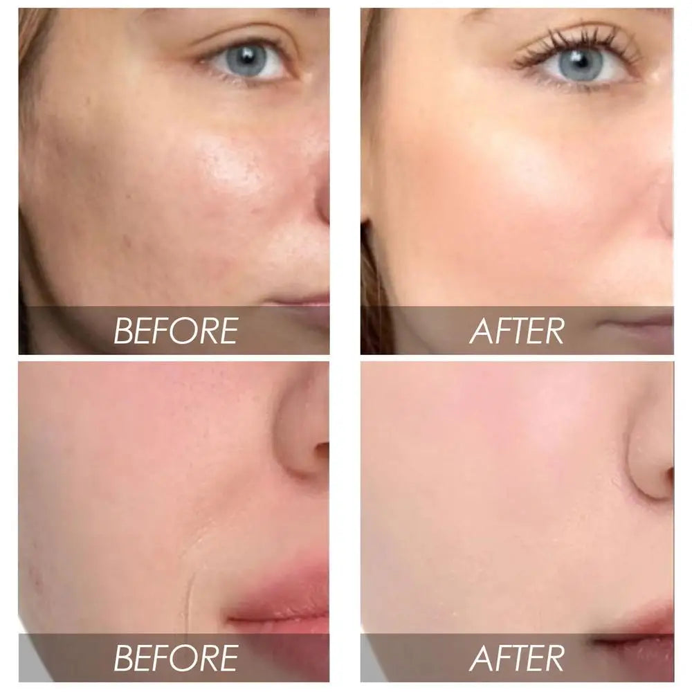 Sérum visage à l'avocat, essence raffermissante visage à la pastèque, effet liftant et raffermissant, atténue les ridules, essence anti-âge, essence anti-rides