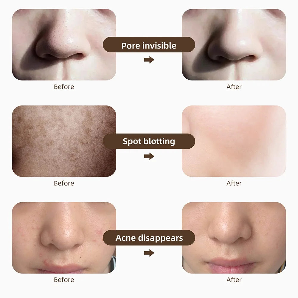 Foreverlily Mascarilla facial LED Wireless 7 Colors Photon Skin Care Beauty Machine Masque pour le visage